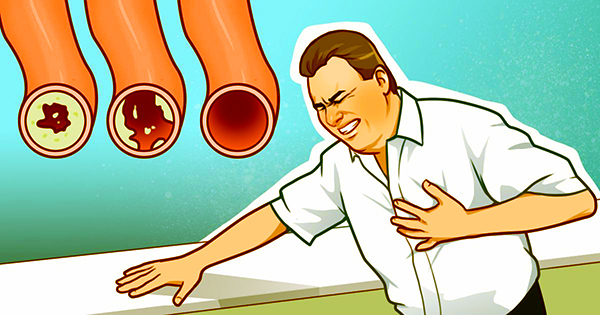 8+ Simple Home Remedies That Help With Cleaning Arteries